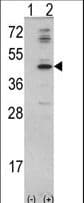 Polyclonal Rabbit anti-Human MVD Antibody (aa7-34, IHC, WB)