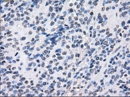BUB1B / BubR1 Antibody (clone OTI3D9)