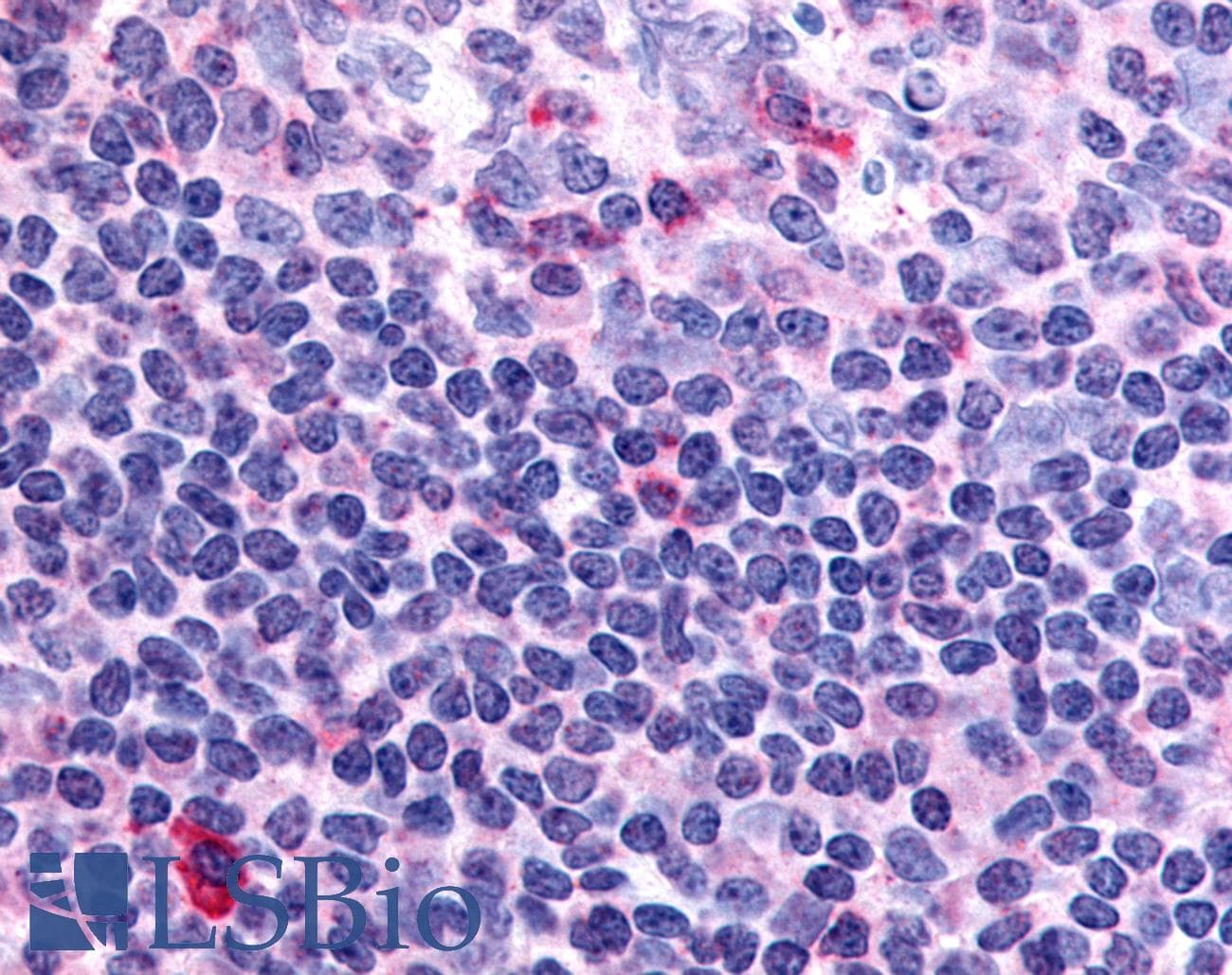 IHC-plus™ F2R / Thrombin Receptor / PAR1 Antibody (N-Terminus)