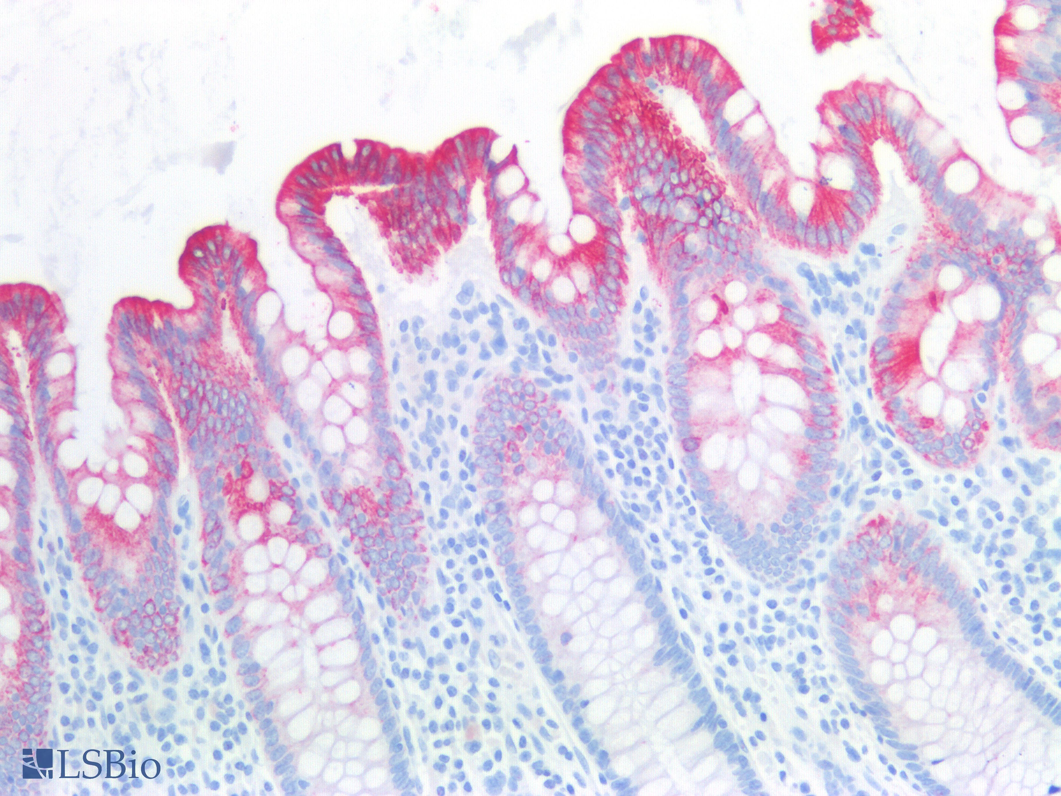 PathPlus™ KRT8 / CK8 / Cytokeratin 8 Antibody (Internal)