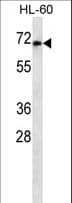 HIPK4 Antibody