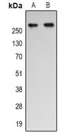 Polyclonal Rabbit anti-Human EP300 / p300 Antibody (Internal, WB)