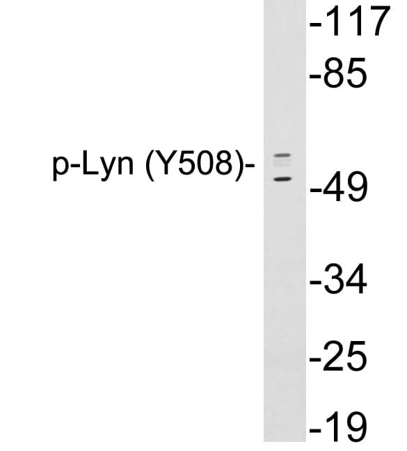 LYN Antibody (phospho-Tyr508)