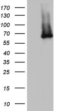 Monoclonal Mouse anti-Human IKZF3 / AIOLOS Antibody (clone OTI4C9, aa1-301, IHC, WB)