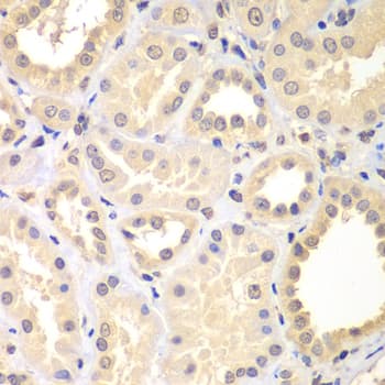 SPIN2B Antibody