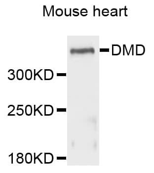 IHC-plus™ Polyclonal Rabbit anti-Human DMD / Dystrophin Antibody (IHC, WB)