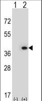 Polyclonal Rabbit anti-Human MLF1 Antibody (aa35-62, WB)