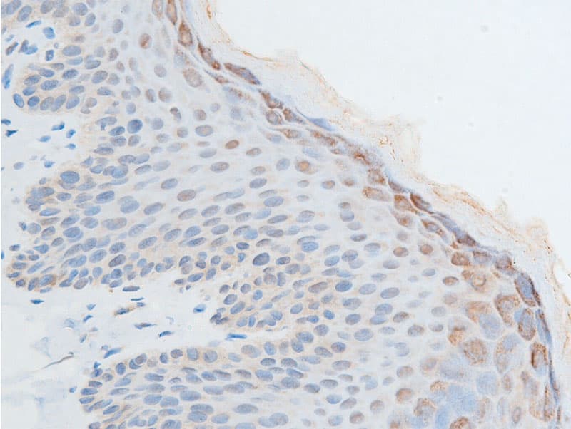 CHEK2 / CHK2 Antibody (phospho-Thr387)