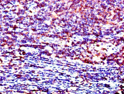 Polyclonal Rabbit anti-Human p56lck / LCK Antibody (aa1-539, WB)