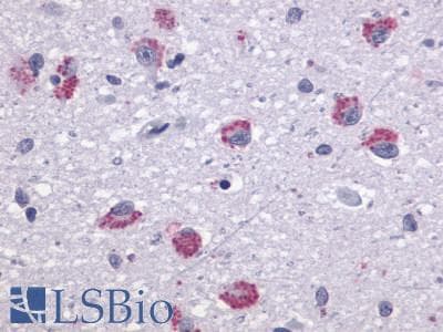 PathPlus™ TAAR1 / TA1 Antibody (Extracellular Domain)