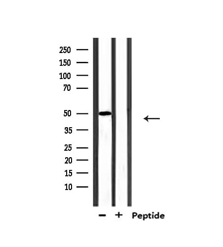Polyclonal Rabbit anti-Human MUC13 Antibody (IHC, IF, WB)