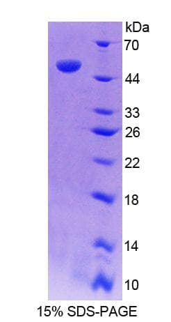 Rat CAMLG / CAML Protein (Recombinant His-GST)