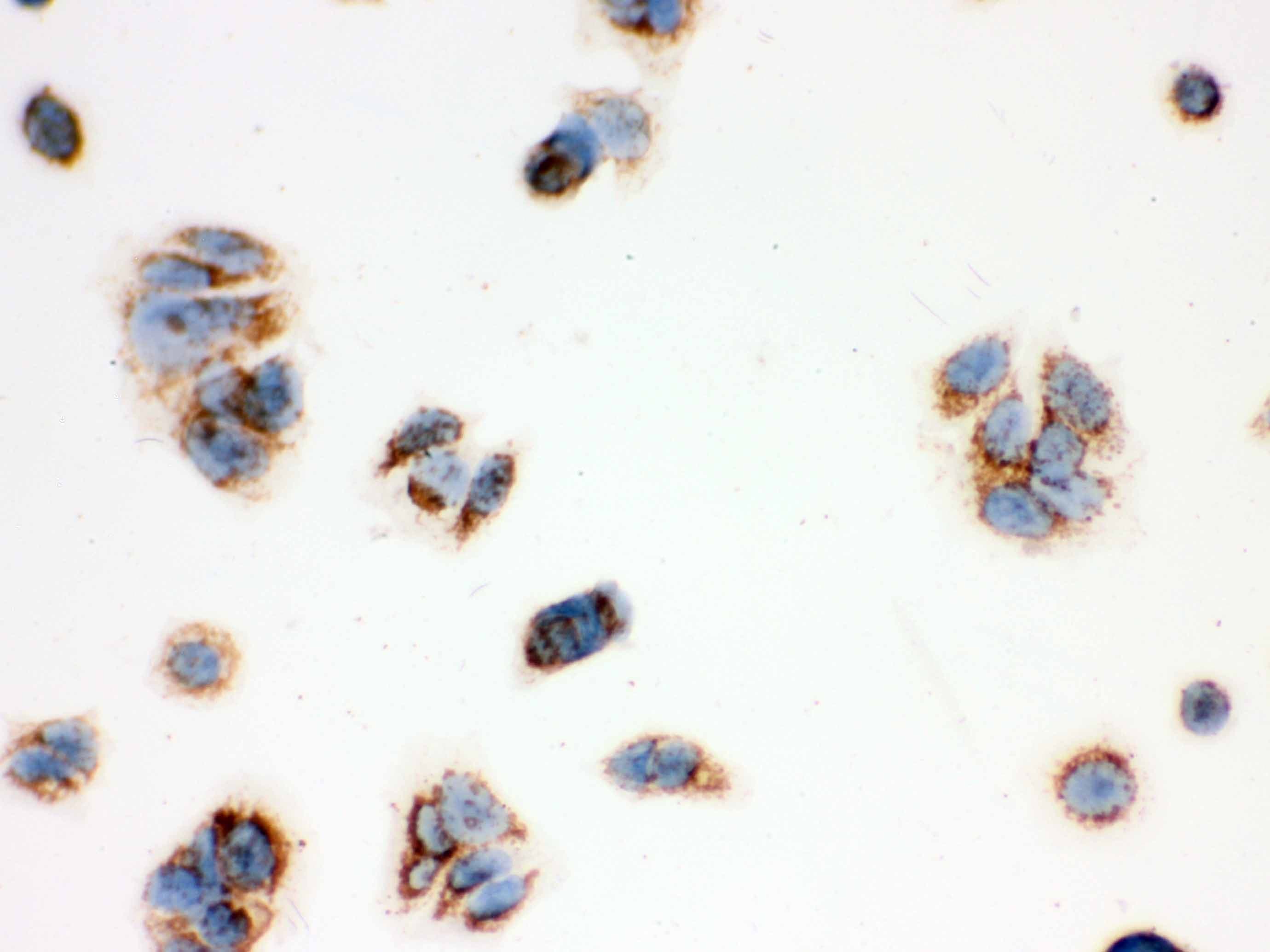 HSD17B10 / HADH2 Antibody (aa48-261)