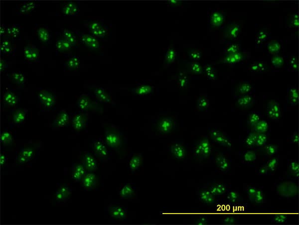 NOP16 Antibody (clone 1G4)