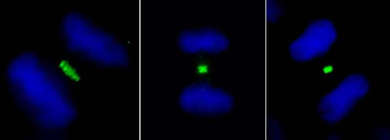 Polyclonal Rabbit anti-Human PLK1 / PLK-1 Antibody (aa325-375, IF, WB)
