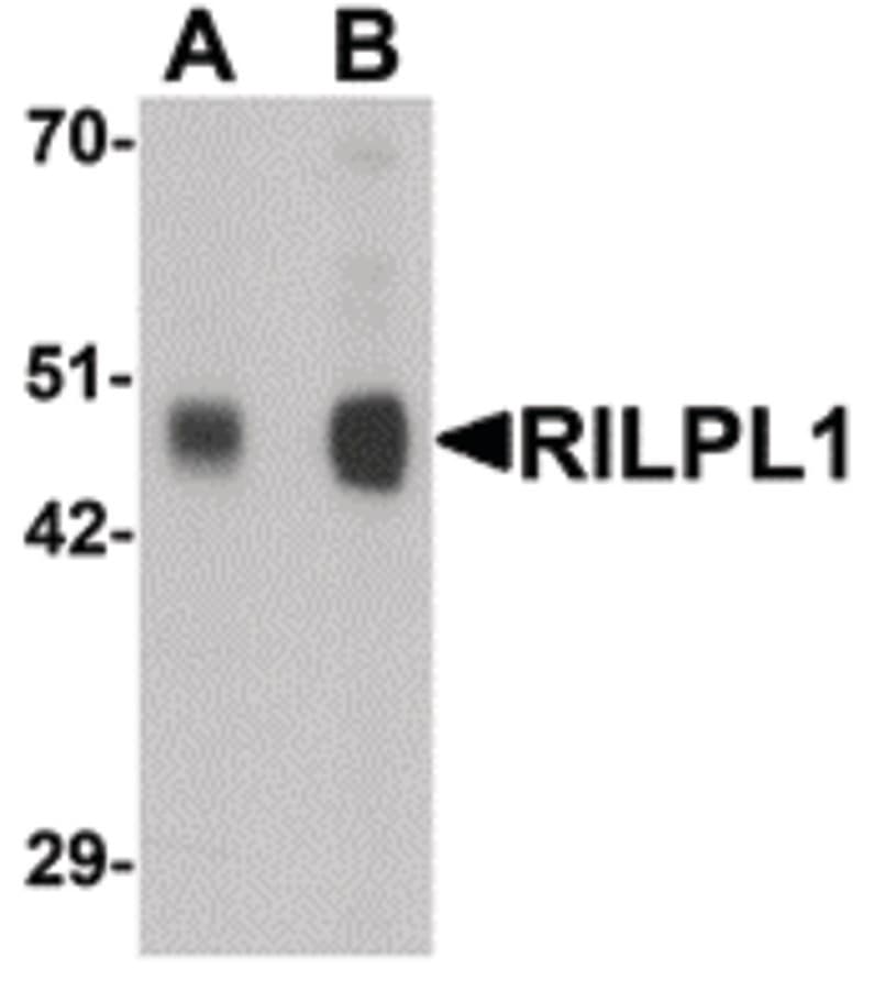 IHC-plus™ RILPL1 Antibody