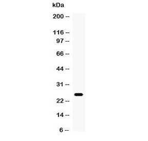 Polyclonal Rabbit anti-Mouse TNF Alpha Antibody (WB)