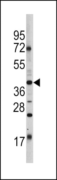 POU5F1 / OCT4 Antibody (aa110-141)