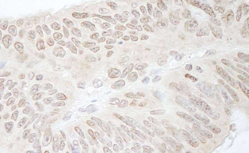 RFC3 Antibody (aa80-110)