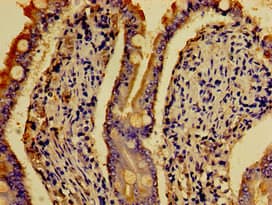 HTR4 / 5-HT4 Receptor Antibody