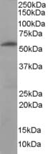 IHC-plus™ FTCD / 58K Golgi Protein Antibody (aa203-216)