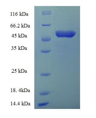 Human ACBD4 Protein (Recombinant His-SUMO)