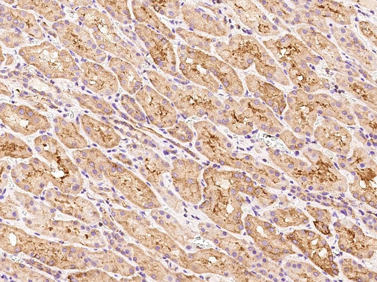 Polyclonal Rabbit anti-Human TPD52L2 / HD54 Antibody (IHC, IF, WB)