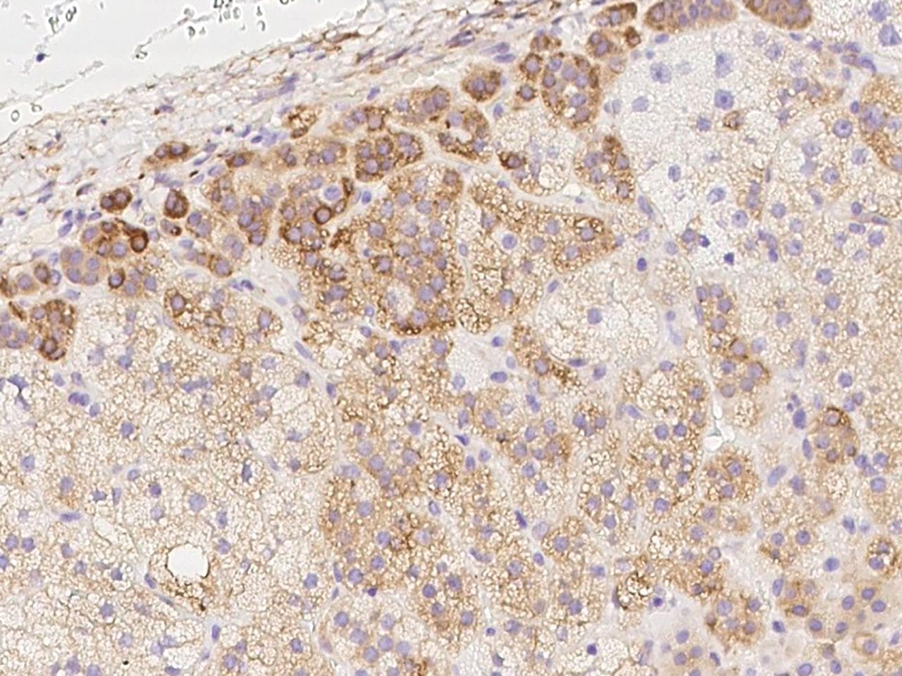 Polyclonal Rabbit anti-Human MXRA7 Antibody (IHC, IF)