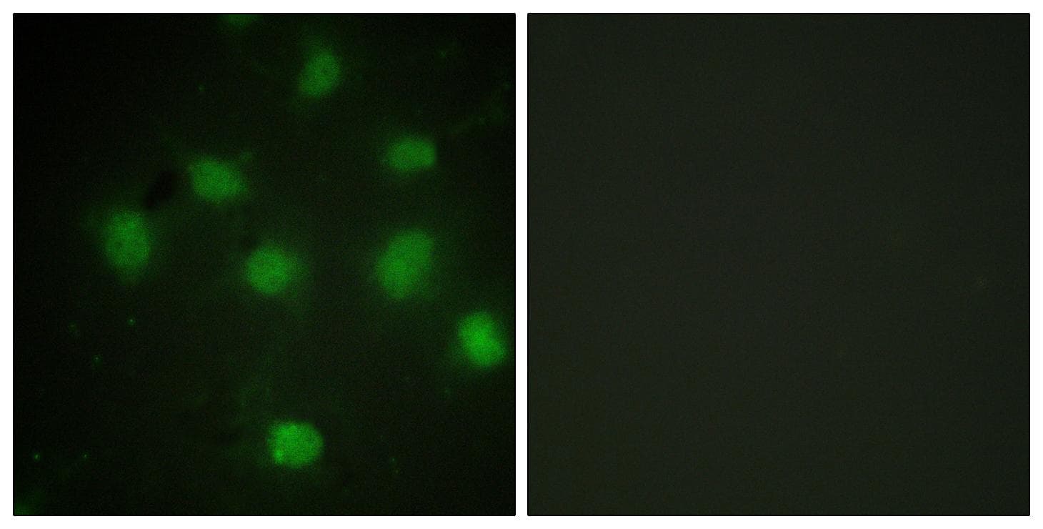 TLK1 Antibody