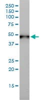 IHC-plus™ KRT17 / CK17 / Cytokeratin 17 Antibody (clone 2D4-1G9)