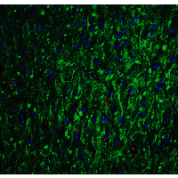 Polyclonal Rabbit anti-Human GLS2 / Glutaminase 2 Antibody (IHC, IF, WB)
