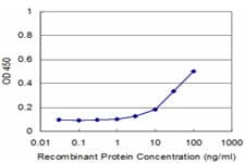 Monoclonal Mouse anti-Human Gravin / AKAP12 Antibody (clone 3C3, WB)
