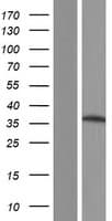 SLC25A19 Protein (Over-Expression Lysate Myc-DDK (Flag))