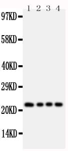 FGF22 Antibody (aa93-109)