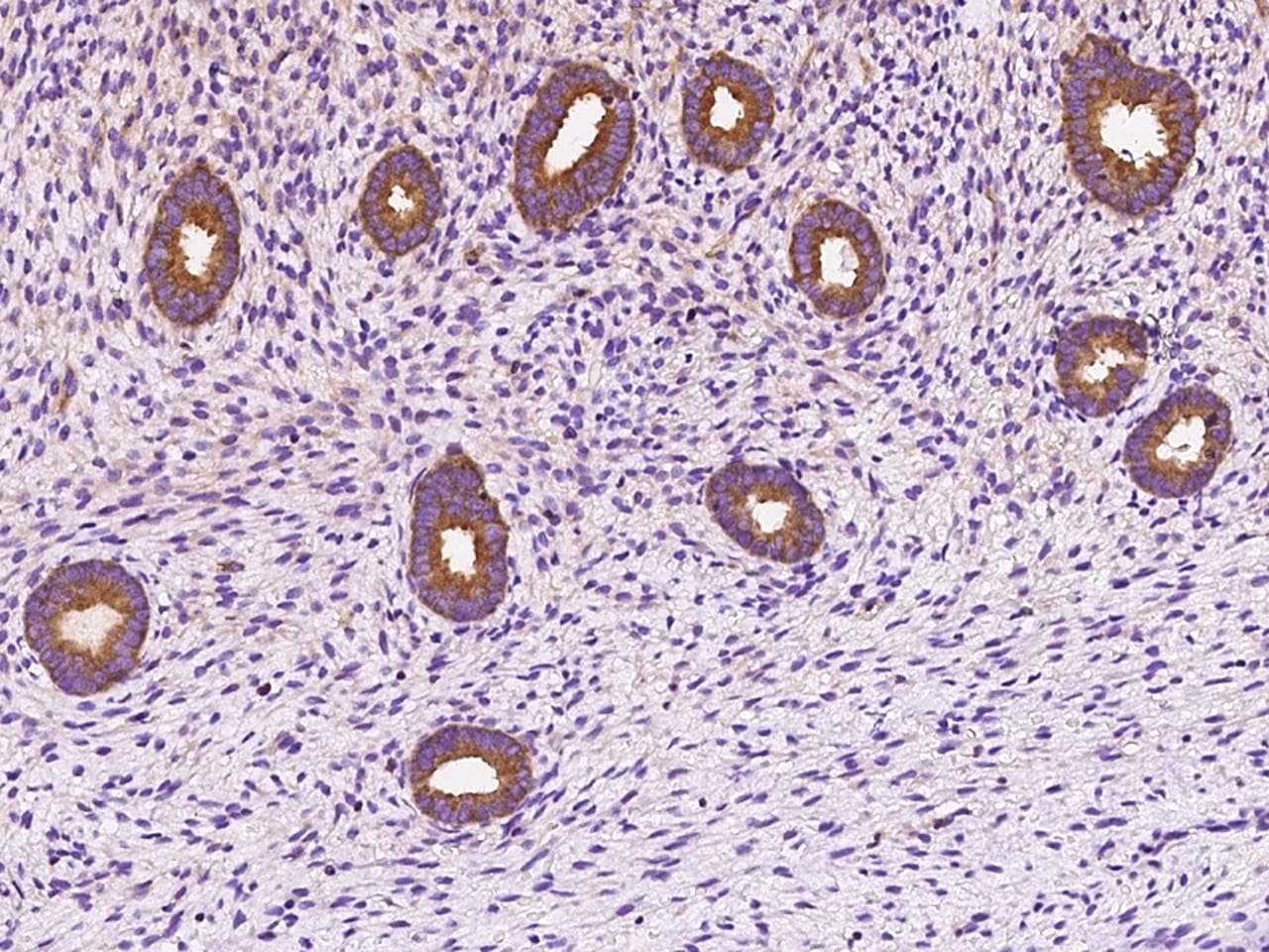 DYNC1LI1 Antibody