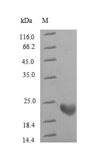 Human RPL9 / Ribosomal Protein L9 (Recombinant GST, N-terminus)
