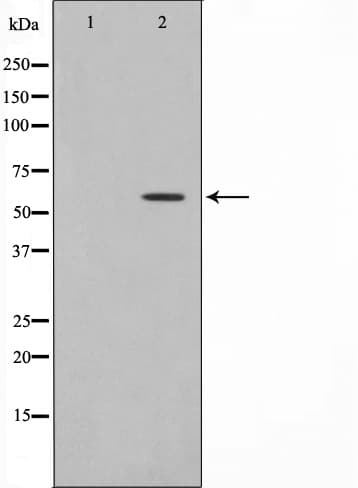 MMP19 Antibody