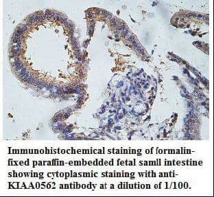 CEP104 Antibody (aa29-181)