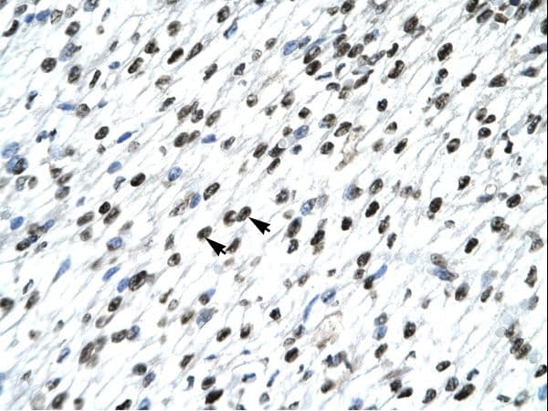 Polyclonal Rabbit anti-Human HOXB9 Antibody (aa67-116, IHC, WB)