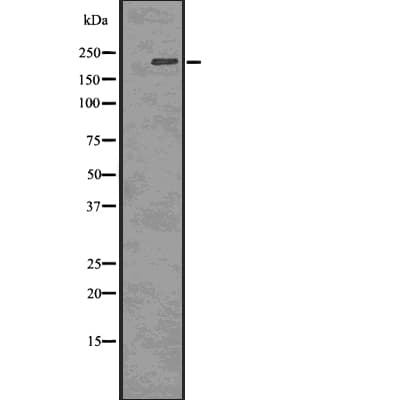 Polyclonal Rabbit anti-Human TP53BP1 / 53BP1 Antibody (phospho-Thr543, IF, WB)