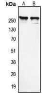 N-CoR / NCOR1 Antibody (N-Terminus)