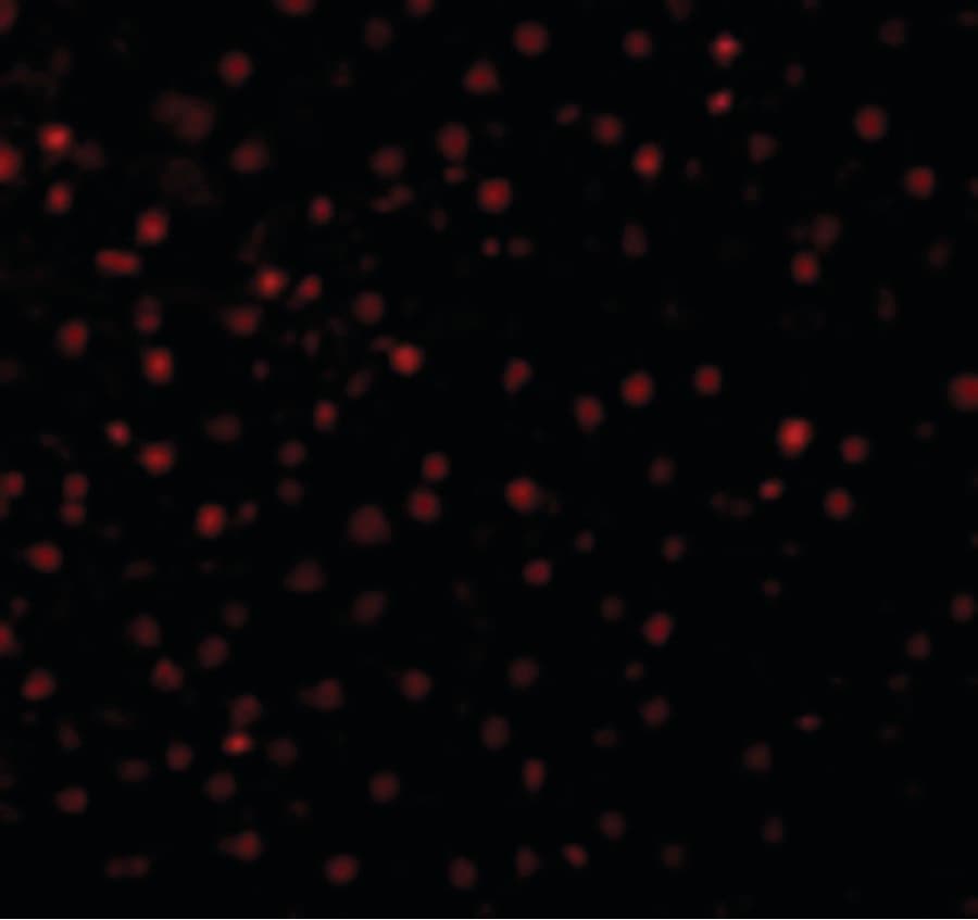 IHC-plus™ Polyclonal Rabbit anti-Human CASP12 / Caspase 12 Antibody (IHC, IF, WB)
