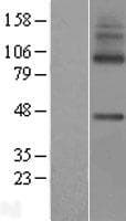 Human MFSD7 / MYL5 Protein (Over-Expression Lysate Myc-DDK (Flag))