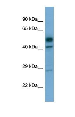 DRAK1 / STK17A Antibody (C-Terminus)