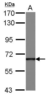 DDX49 Antibody