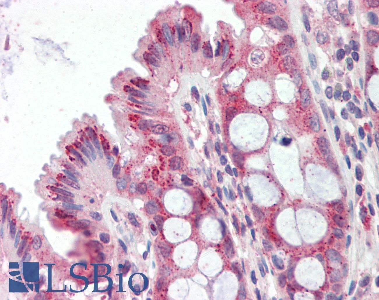 IHC-plus™ ITPR2 / IP3 Receptor Type 2 Antibody (C-Terminus)