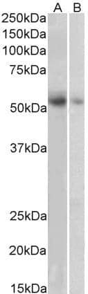 IHC-plus™ SLC18A2 / VMAT2 Antibody (C-Terminus)