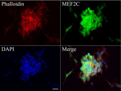 MEF2C Antibody (clone UMAB17)
