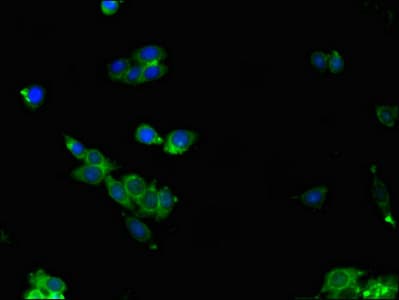 Polyclonal Rabbit anti-Human ALDOC / Aldolase C Antibody (IHC, IF, WB)