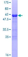 Human IL-1B / IL-1 Beta Protein (Recombinant GST)